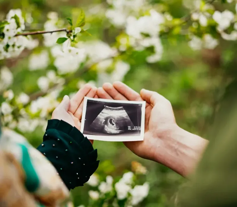 Kvinna som håller ultraljudsbild